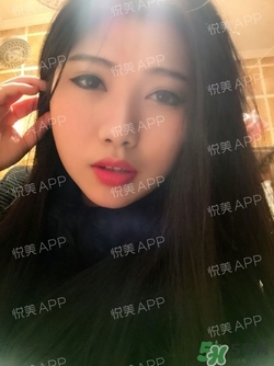切開雙眼皮消腫過程圖_切開雙眼皮恢復過程圖