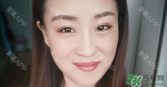 埋線雙眼皮能保持多久？埋線雙眼皮是永久嗎