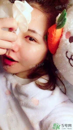定點雙眼皮恢復過程圖_定點雙眼皮要多久恢復