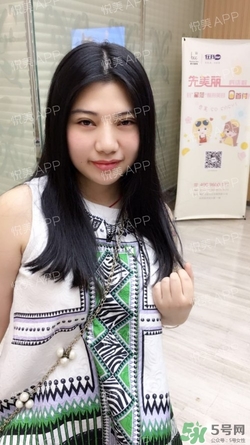 切開雙眼皮消腫過程圖_切開雙眼皮恢復過程圖