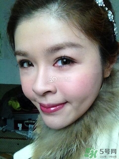 重瞼術是什么？重瞼術是永久的嗎？