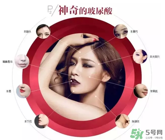 喬雅登是哪個(gè)國(guó)家的？喬雅登玻尿酸哪個(gè)國(guó)家？