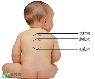 三九貼能治什么病？三九貼的作用