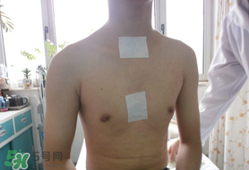 三九貼怎么貼？三九貼的貼法