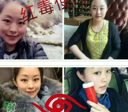 美國(guó)紅毒溶脂怎么樣？美國(guó)紅毒溶脂有用嗎？