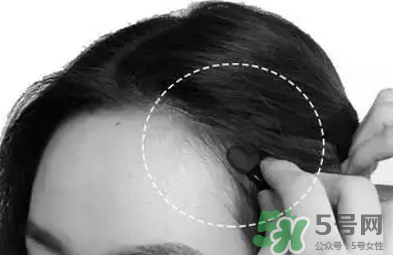 發(fā)際線高適合什么發(fā)型？發(fā)際線高怎么辦