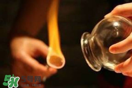 拔罐放血能治皮膚病嗎？拔罐放血能治牛皮癬嗎？