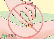 水泡怎么處理？水泡要不要刺破？