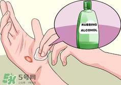 水泡怎么處理？水泡要不要刺破？