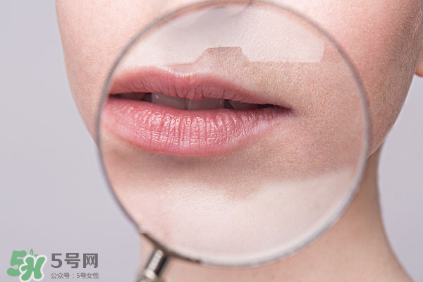 嘴唇起泡腫了怎么辦？嘴唇起泡腫了怎么消腫