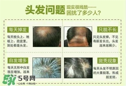 牛角梳梳頭可以生發(fā)嗎？牛角梳怎么梳頭？