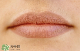 卡唇紋是什么意思？卡唇紋怎么辦？