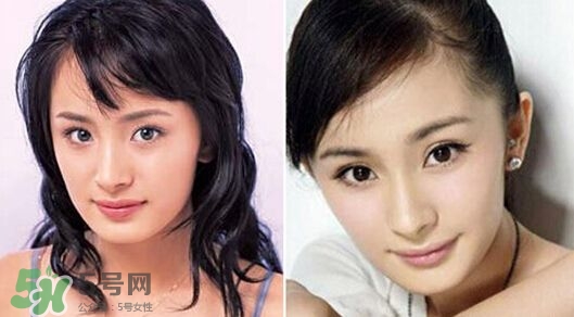 打瘦臉針能懷孕嗎？打瘦臉針能吃避孕藥嗎？