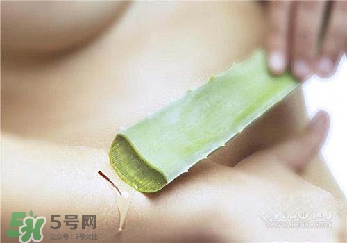 蘆薈涂在臉上發(fā)癢是怎么回事？蘆薈涂在臉上發(fā)癢怎么辦？