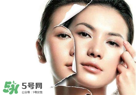 美白針是什么？美白針可以連續(xù)打嗎？