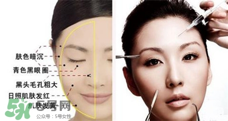 美白針的效果明顯嗎？美白針一個療程幾次？