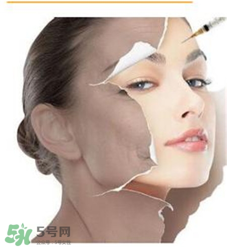 美白針安全嗎？美白針可以自己注射嗎？