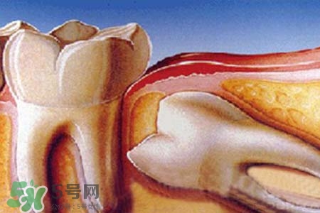 智齒經(jīng)常發(fā)炎怎么辦？智齒反復(fù)發(fā)炎腫痛怎么辦？