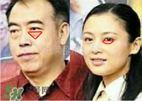 臥蠶是黑眼圈嗎？臥蠶和黑眼圈的區(qū)別