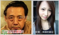 臥蠶是黑眼圈嗎？臥蠶和黑眼圈的區(qū)別