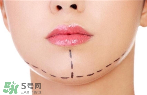 玻尿酸墊下巴能維持多久？玻尿酸墊下巴能維持多長(zhǎng)時(shí)間？