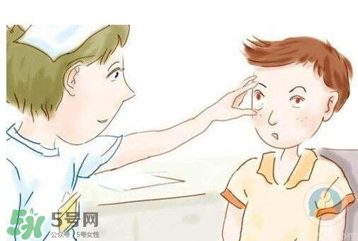 紅眼病用什么眼藥水好？紅眼病吃什么好得快
