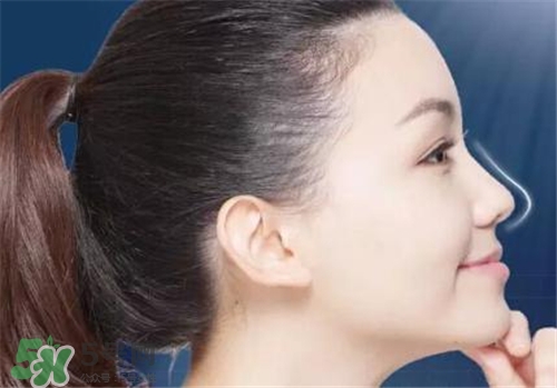 隆鼻會(huì)拉近眼距嗎？隆鼻會(huì)改變眼睛嗎？