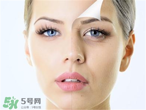 玻尿酸除皺有效果嗎？玻尿酸除皺效果怎么樣？