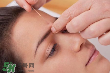 沒病可以針灸嗎？沒病可以扎針嗎？