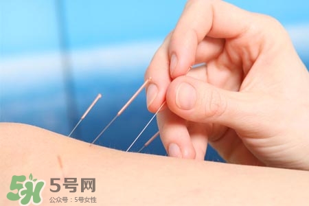 沒病可以針灸嗎？沒病可以扎針嗎？