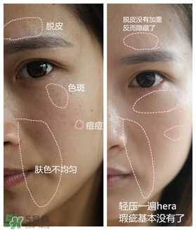 赫拉氣墊用了悶痘嗎？赫拉氣墊悶痘怎么辦？