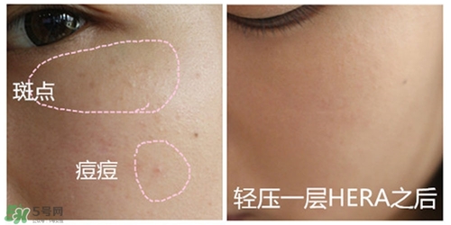 赫拉氣墊用了悶痘嗎？赫拉氣墊悶痘怎么辦？