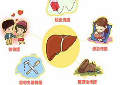 肝炎會(huì)傳染嗎？肝炎會(huì)不會(huì)傳染別人？