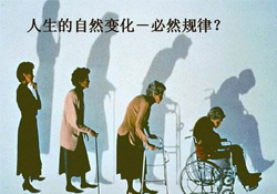 哪些人容易得骨質(zhì)疏松癥？骨質(zhì)疏松的高發(fā)人群有哪些？