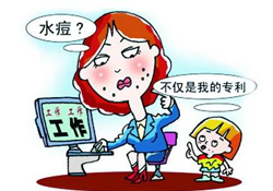 怎么判斷水痘好了？水痘快好了有什么癥狀？