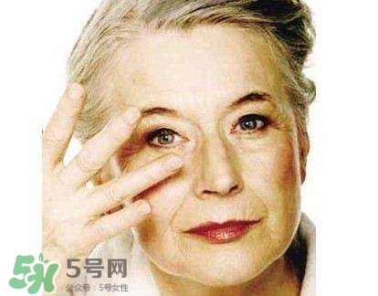 老年斑是怎么形成的？老年斑的形成原因