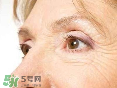 老年斑是怎么形成的？老年斑的形成原因
