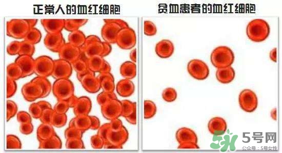 缺鐵性貧血的癥狀 缺鐵性貧血的癥狀有哪些？