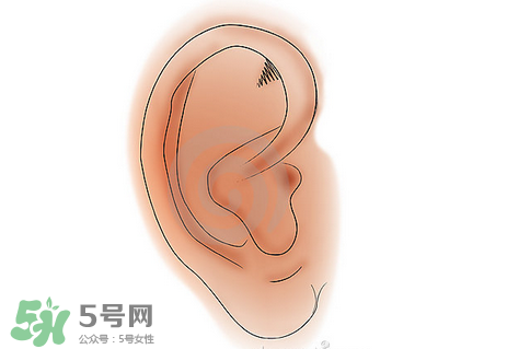 中耳炎有什么癥狀？中耳炎的癥狀表現(xiàn)