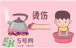 燙傷可以用牙膏嗎？燙傷用牙膏管用嗎？