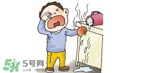 燙傷可以用牙膏嗎？燙傷用牙膏管用嗎？