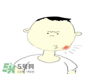 嘴角起泡是什么原因？嘴角起泡怎么辦？