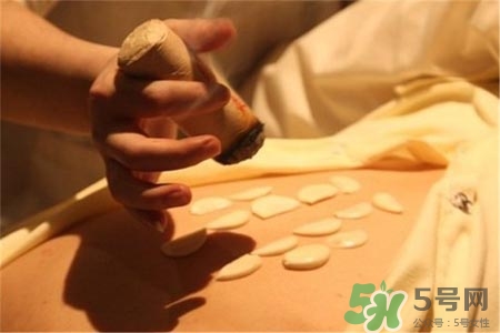 艾灸能治療婦科病嗎？艾灸為什么可以治療婦科??？