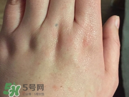 薇諾娜適合什么皮膚？薇諾娜適合敏感肌嗎？