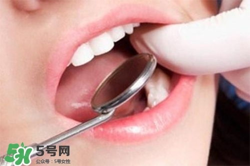 口腔異味是怎么回事？口腔異味怎么清除？