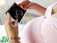 保胎期間可以洗澡嗎？臥床保胎可以洗澡嗎？