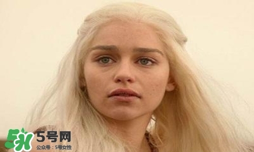 臉色發(fā)黃是什么原因？臉色發(fā)黃吃什么調理更好？