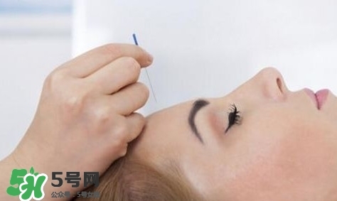 叢集性頭痛會死人嗎？叢集性頭痛的特點