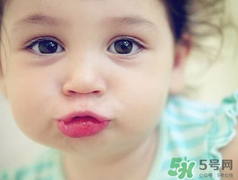 孕期可以激光祛斑嗎？懷孕了能做激光祛斑嗎？