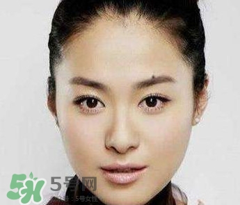 如何預(yù)防臉上長痣？怎樣預(yù)防臉上長痣